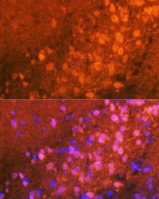 Immunohistochemistry: JNK1/2/3 Antibody (0J5D8) [NBP3-16250]