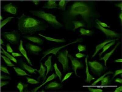 Immunocytochemistry/ Immunofluorescence: JNK1 Antibody (2F11) [H00005599-M11]