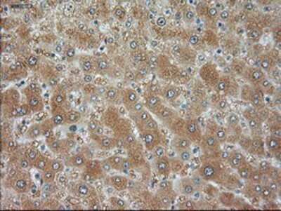 Immunohistochemistry-Paraffin: JNK1 Antibody (OTI4E3) [NBP1-48284]