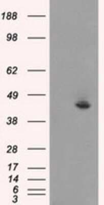 Western Blot: JNK1 Antibody (OTI4E3) [NBP1-48284]