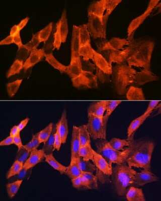 Immunocytochemistry/ Immunofluorescence: JNK1 Antibody (8Q7S4) [NBP3-16536]