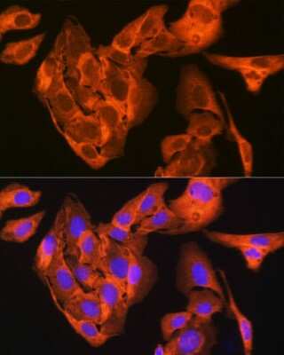 Immunocytochemistry/ Immunofluorescence: JNK1 Antibody (8Q7S4) [NBP3-16536]