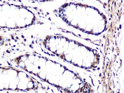 Immunohistochemistry-Paraffin: JNK1 Antibody (8Q7S4) [NBP3-16536]
