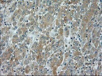 Immunohistochemistry: JNK1 Antibody (OTI4E3) - Azide and BSA Free [NBP2-71256]