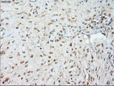 Immunohistochemistry: JNK1 Antibody (OTI4E3) - Azide and BSA Free [NBP2-71256]
