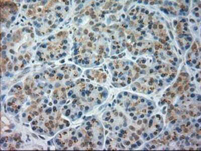 Immunohistochemistry: JNK1 Antibody (OTI4E3) - Azide and BSA Free [NBP2-71256]
