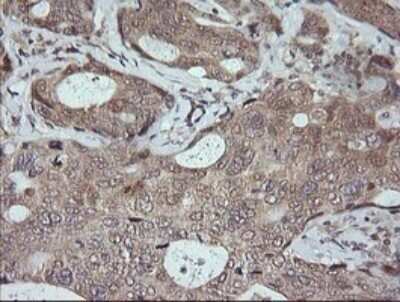 Immunohistochemistry: JNK2 Antibody (OTI1A1) - Azide and BSA Free [NBP2-71259]