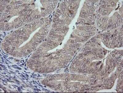 Immunohistochemistry: JNK2 Antibody (OTI1A1) - Azide and BSA Free [NBP2-71259]