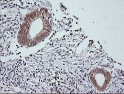 Immunohistochemistry: JNK2 Antibody (OTI1A1) - Azide and BSA Free [NBP2-71259]