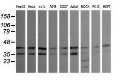 Western Blot: JNK2 Antibody (OTI1A1)Azide and BSA Free [NBP2-71259]