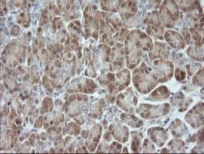 Immunohistochemistry: JNK2 Antibody (OTI1A1) [NBP2-45815]