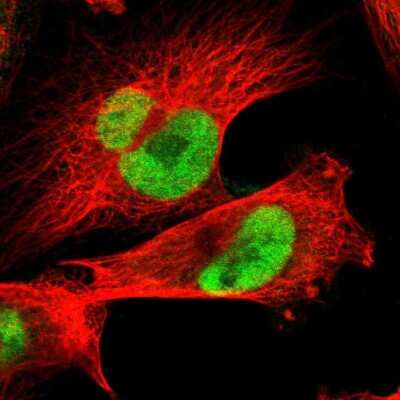 Immunocytochemistry/ Immunofluorescence: JPH1 Antibody [NBP1-83076]