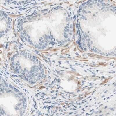 Immunohistochemistry-Paraffin: JPH1 Antibody [NBP1-83075]
