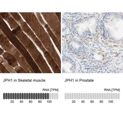 Immunohistochemistry-Paraffin: JPH1 Antibody [NBP1-83075]