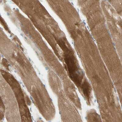 Immunohistochemistry-Paraffin: JPH1 Antibody [NBP1-83076]