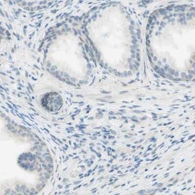Immunohistochemistry-Paraffin: JPH1 Antibody [NBP1-83076]