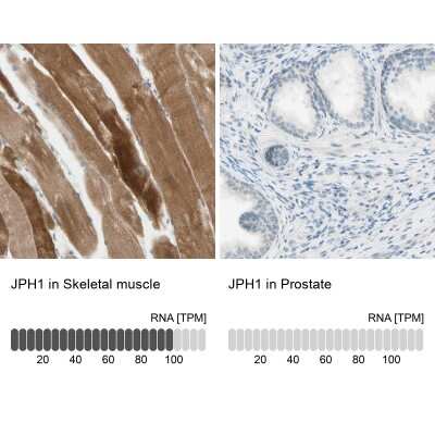 Immunohistochemistry-Paraffin: JPH1 Antibody [NBP1-83076]
