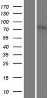Western Blot: JPH2 Overexpression Lysate [NBP2-06649]