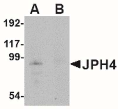 Western Blot: JPH4 AntibodyBSA Free [NBP2-41095]