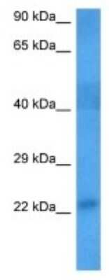 Western Blot: JWA Antibody [NBP3-09996]