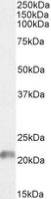 Western Blot: JWA Antibody [NBP3-12158]