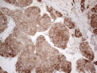 Immunohistochemistry: Jagged 1 Antibody (OTI3A10) [NBP2-45467]