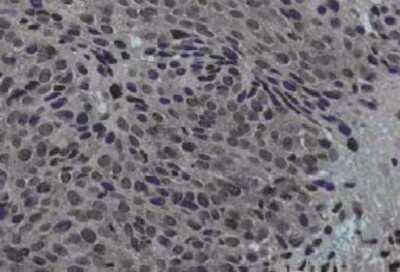 Immunohistochemistry: Jagged 1 Antibody [NB600-1161]