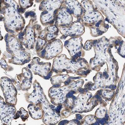 Immunohistochemistry-Paraffin: Jagged 1 Antibody [NBP1-90208]