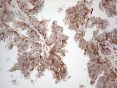 Immunohistochemistry: Jagged 1 Antibody (OTI3A10) - Azide and BSA Free [NBP2-70115]