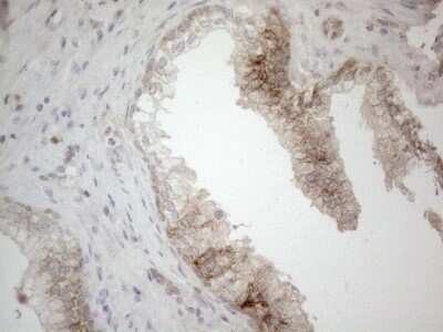 Immunohistochemistry: Jagged 1 Antibody (OTI3A10) - Azide and BSA Free [NBP2-70115]