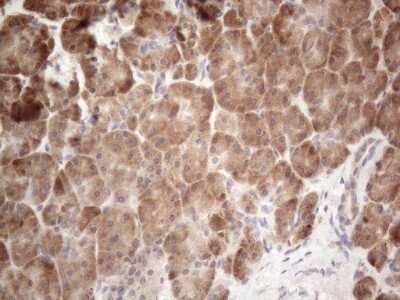 Immunohistochemistry: Jagged 1 Antibody (OTI3A10) - Azide and BSA Free [NBP2-70115]