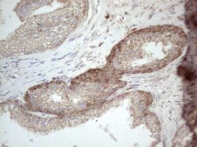 Immunohistochemistry: Jagged 1 Antibody (OTI3A10) - Azide and BSA Free [NBP2-70115]