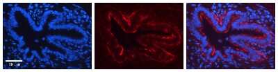 Immunohistochemistry: Jagged 2 Antibody [NBP1-58284]