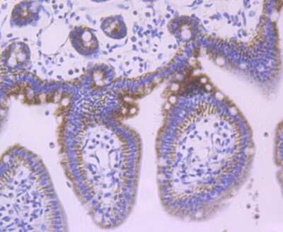 Immunohistochemistry-Paraffin: Jak1 Antibody (JM75-03) [NBP2-75547]