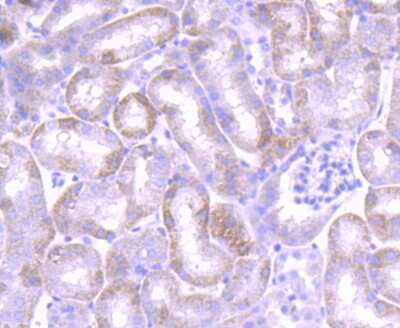 Immunohistochemistry-Paraffin: Jak1 Antibody (JM75-03) [NBP2-75547]