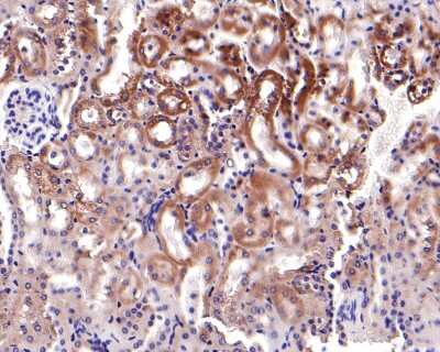 Immunohistochemistry-Paraffin: Jak1 Antibody (JM75-03) [NBP2-75547]