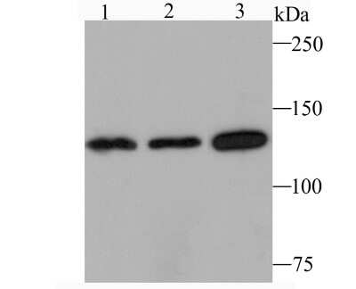 Western Blot: Jak1 Antibody (JM75-03) [NBP2-75547]