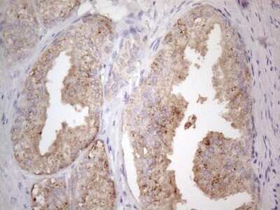 Immunohistochemistry: Jak2 Antibody (OTI7D12) - Azide and BSA Free [NBP2-71056]