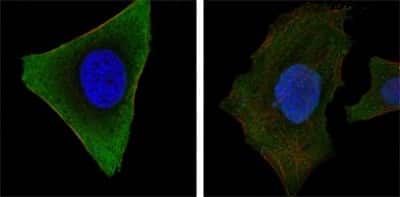 Immunocytochemistry/ Immunofluorescence: Jak3 Antibody (5H2) - BSA Free [NBP2-37737]
