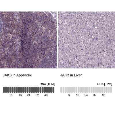 Immunohistochemistry-Paraffin: Jak3 Antibody [NBP2-49629]