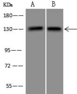 Western Blot: Jak3 Antibody [NBP3-12702]