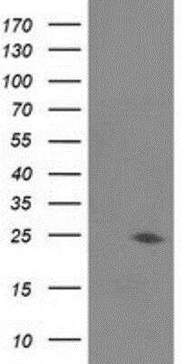 Western Blot: Josephin1 Antibody (OTI3B11) [NBP2-03442]