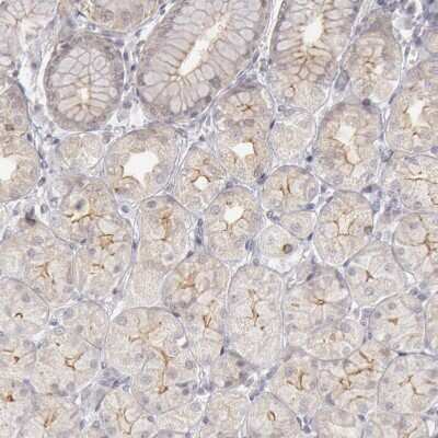 Immunohistochemistry-Paraffin: Josephin1 Antibody [NBP1-87864]