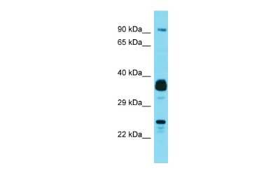 Western Blot: Josephin1 Antibody [NBP2-85125]