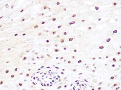 Immunohistochemistry-Paraffin: JunB/AP-1 Antibody (3U10K1) [NBP3-16491]