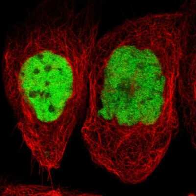 Immunocytochemistry/ Immunofluorescence: JunB/AP-1 Antibody [NBP1-89544]