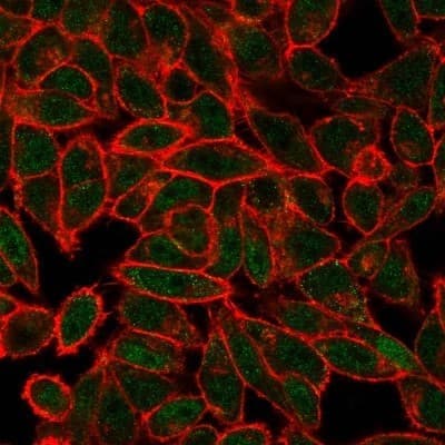 Immunocytochemistry/ Immunofluorescence: JunB/AP-1 Antibody (PCRP-JUNB-3G2) [NBP3-07579]