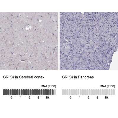 Immunohistochemistry-Paraffin: KA1/GRIK4/Glutamate Receptor KA1 Antibody [NBP2-62686]