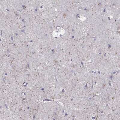 Immunohistochemistry-Paraffin: KA1/GRIK4/Glutamate Receptor KA1 Antibody [NBP2-62686]