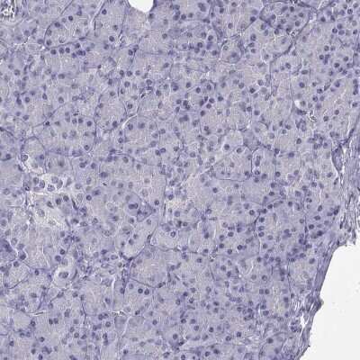 Immunohistochemistry-Paraffin: KA1/GRIK4/Glutamate Receptor KA1 Antibody [NBP2-62686]
